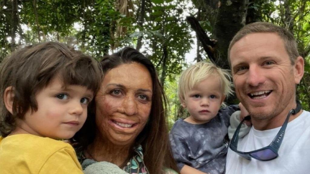 Histoire inspirante Turia Pitt : Michael Hoskin est toujours resté auprès d'elle, même après le drame