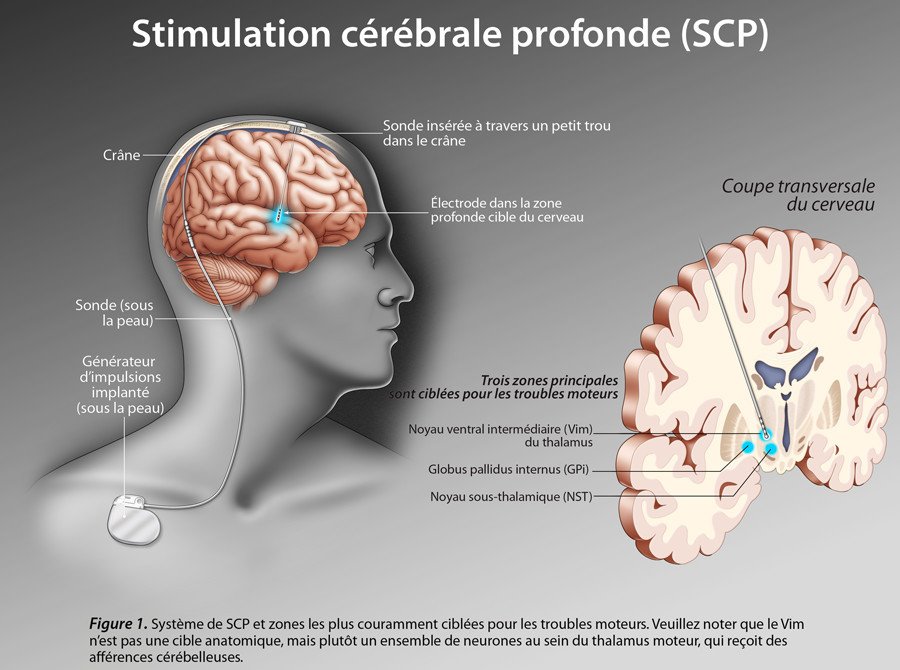Lire la suite à propos de l’article Troubles obsessionnels compulsifs : Comment soigner les TOC ?